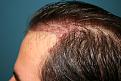 Click image for larger version

Name:	Immed Post-Op 2.jpg
Views:	418
Size:	97.1 KB
ID:	456060