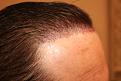 Click image for larger version

Name:	Immed Pot-Op-2.jpg
Views:	321
Size:	86.9 KB
ID:	456199