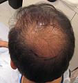 Click image for larger version

Name:	IMG_0175.jpg
Views:	357
Size:	88.2 KB
ID:	456218