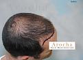 Click image for larger version

Name:	18_Before.jpg
Views:	406
Size:	79.1 KB
ID:	456297