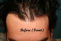 Click image for larger version

Name:	Before-1 (1).jpg
Views:	560
Size:	88.2 KB
ID:	456301