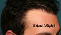 Click image for larger version

Name:	Before-2 (2).jpg
Views:	527
Size:	93.5 KB
ID:	456302