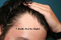 Click image for larger version

Name:	After-2 (2)_Copy.jpg
Views:	519
Size:	93.2 KB
ID:	456308