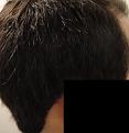 Click image for larger version

Name:	Right Scar.JPG
Views:	1052
Size:	43.7 KB
ID:	456316