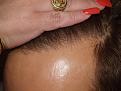 Click image for larger version

Name:	After Hairline.jpg
Views:	345
Size:	96.6 KB
ID:	456376