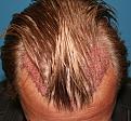 Click image for larger version

Name:	Immed Post-Op-2.jpg
Views:	341
Size:	93.6 KB
ID:	456545