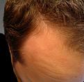 Click image for larger version

Name:	2012-02-22-089.jpg
Views:	552
Size:	77.6 KB
ID:	456704