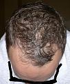 Click image for larger version

Name:	2012-04-01-860.jpg
Views:	572
Size:	93.7 KB
ID:	456705