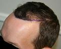 Click image for larger version

Name:	2012-04-02 -  Dr. Feller Pics 01.jpg
Views:	604
Size:	45.8 KB
ID:	456706