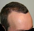 Click image for larger version

Name:	2012-04-02 -  Dr. Feller Pics 02.jpg
Views:	556
Size:	33.3 KB
ID:	456707