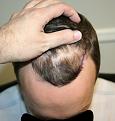 Click image for larger version

Name:	2012-04-02 -  Dr. Feller Pics 03.jpg
Views:	568
Size:	91.3 KB
ID:	456708
