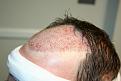 Click image for larger version

Name:	2012-04-02 -  Dr. Feller Pics 04.jpg
Views:	551
Size:	39.7 KB
ID:	456709