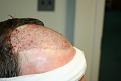 Click image for larger version

Name:	2012-04-02 -  Dr. Feller Pics 05.jpg
Views:	555
Size:	34.4 KB
ID:	456710