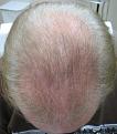 Click image for larger version

Name:	IMG_3871.jpg
Views:	432
Size:	90.9 KB
ID:	457984