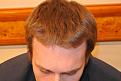 Click image for larger version

Name:	chris hair 1.jpg
Views:	527
Size:	87.8 KB
ID:	458013