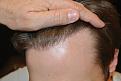 Click image for larger version

Name:	chris hair 4.jpg
Views:	540
Size:	91.2 KB
ID:	458015