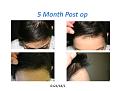 Click image for larger version

Name:	Slide1.JPG
Views:	287
Size:	48.6 KB
ID:	458404