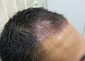 Click image for larger version

Name:	IMG_1703.jpg
Views:	481
Size:	89.6 KB
ID:	458423