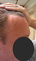 Click image for larger version

Name:	IMAG0122_hair.jpg
Views:	412
Size:	47.0 KB
ID:	458505