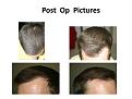 Click image for larger version

Name:	Slide2.JPG
Views:	394
Size:	50.8 KB
ID:	458626