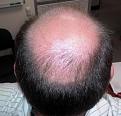 Click image for larger version

Name:	back of head.jpg
Views:	755
Size:	62.7 KB
ID:	458660