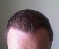 Click image for larger version

Name:	Hairline 2.jpg
Views:	2392
Size:	86.5 KB
ID:	458688