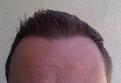 Click image for larger version

Name:	Hairline 3.jpg
Views:	1865
Size:	92.1 KB
ID:	458689