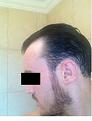 Click image for larger version

Name:	Left Side Pre-Op (Wet).jpg
Views:	1248
Size:	7.6 KB
ID:	458806