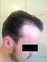 Click image for larger version

Name:	Right Side Pre-Op (Wet).jpg
Views:	1394
Size:	7.4 KB
ID:	458807