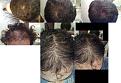 Click image for larger version

Name:	lunapic_134541844974639_3.jpg
Views:	10451
Size:	91.1 KB
ID:	458814