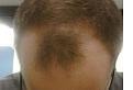 Click image for larger version

Name:	bald.JPG
Views:	823
Size:	12.9 KB
ID:	458842
