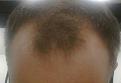 Click image for larger version

Name:	bald2.JPG
Views:	1747
Size:	7.3 KB
ID:	458843