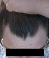 Click image for larger version

Name:	hairlinedeepangle2012.jpg
Views:	19866
Size:	33.0 KB
ID:	458851