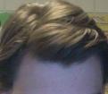 Click image for larger version

Name:	hairline2011.jpg
Views:	11926
Size:	16.3 KB
ID:	458855