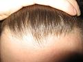 Click image for larger version

Name:	hairlineclose2010.jpg
Views:	29335
Size:	95.7 KB
ID:	458858