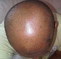 Click image for larger version

Name:	Head - Top.jpg
Views:	486
Size:	96.6 KB
ID:	458967