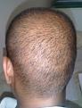 Click image for larger version

Name:	Head - Back 1.jpg
Views:	452
Size:	87.0 KB
ID:	458968
