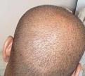 Click image for larger version

Name:	Head - Back 2.jpg
Views:	434
Size:	53.0 KB
ID:	458969