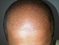 Click image for larger version

Name:	Head - Front.jpg
Views:	468
Size:	58.7 KB
ID:	458970