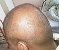 Click image for larger version

Name:	Head - Left 1.jpg
Views:	433
Size:	89.7 KB
ID:	458971