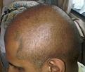 Click image for larger version

Name:	Head - Left 2.jpg
Views:	443
Size:	53.7 KB
ID:	458972