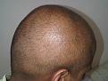 Click image for larger version

Name:	Head - Right 1.jpg
Views:	428
Size:	84.2 KB
ID:	458973