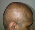 Click image for larger version

Name:	Head - Right 2.jpg
Views:	456
Size:	71.4 KB
ID:	458974