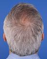 Click image for larger version

Name:	14. Tilted Up_ 5 Months.JPG
Views:	435
Size:	94.7 KB
ID:	459047