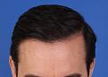 Click image for larger version

Name:	2. Tilted Down_9 Months.JPG
Views:	433
Size:	66.1 KB
ID:	459058
