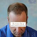 Click image for larger version

Name:	4_After.jpg
Views:	474
Size:	75.9 KB
ID:	459349