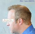 Click image for larger version

Name:	8_After.jpg
Views:	693
Size:	82.6 KB
ID:	459353