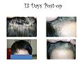 Click image for larger version

Name:	Slide3.JPG
Views:	334
Size:	65.6 KB
ID:	459366