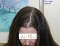 Click image for larger version

Name:	5_After-two-years.jpg
Views:	934
Size:	89.8 KB
ID:	459389