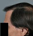 Click image for larger version

Name:	9.jpg
Views:	502
Size:	87.2 KB
ID:	459507